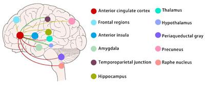 Frontiers Sex Differences In Chronic Pain Induced Mental Disorders